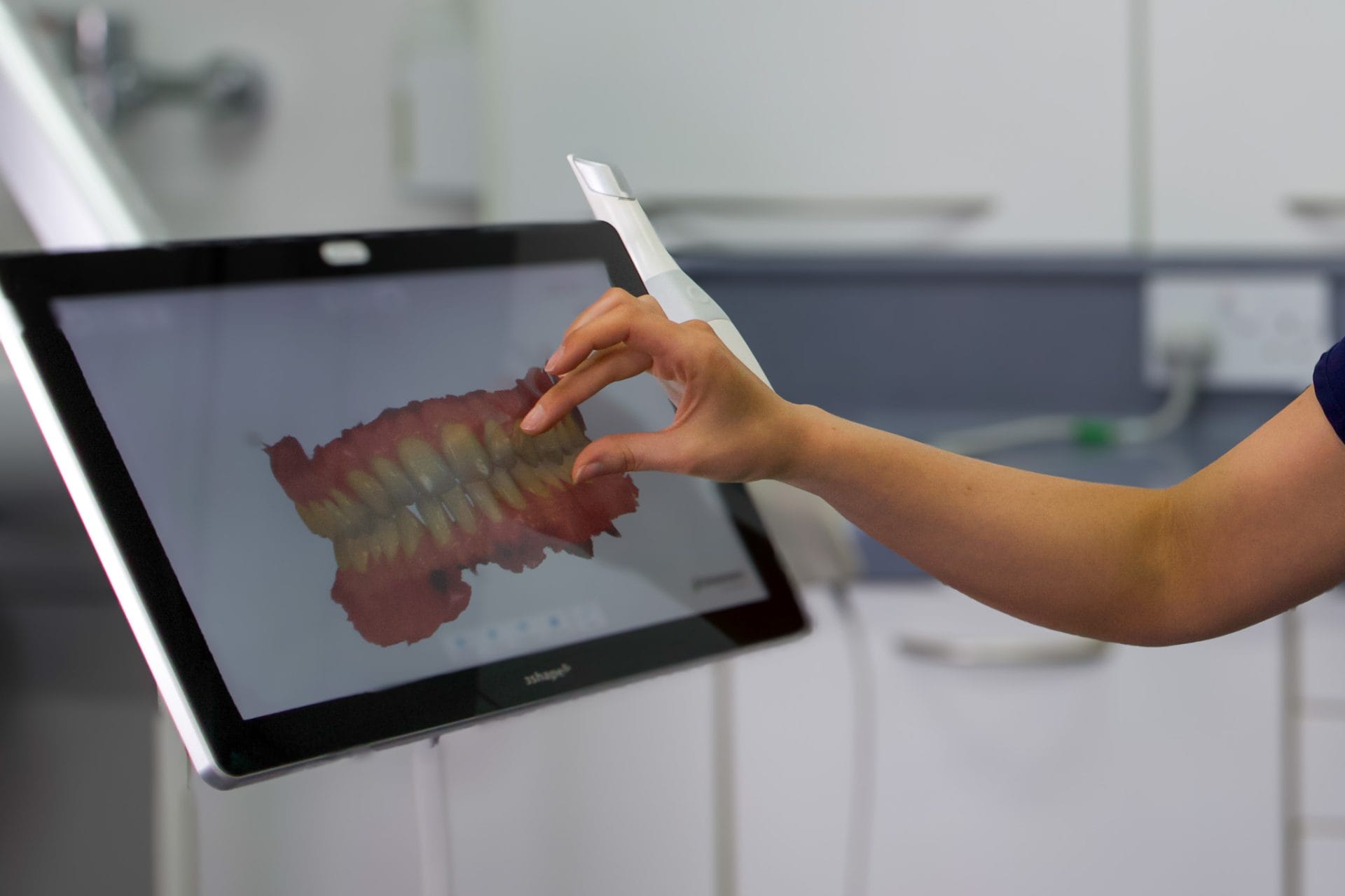 What Can Composite Bonding Improve?