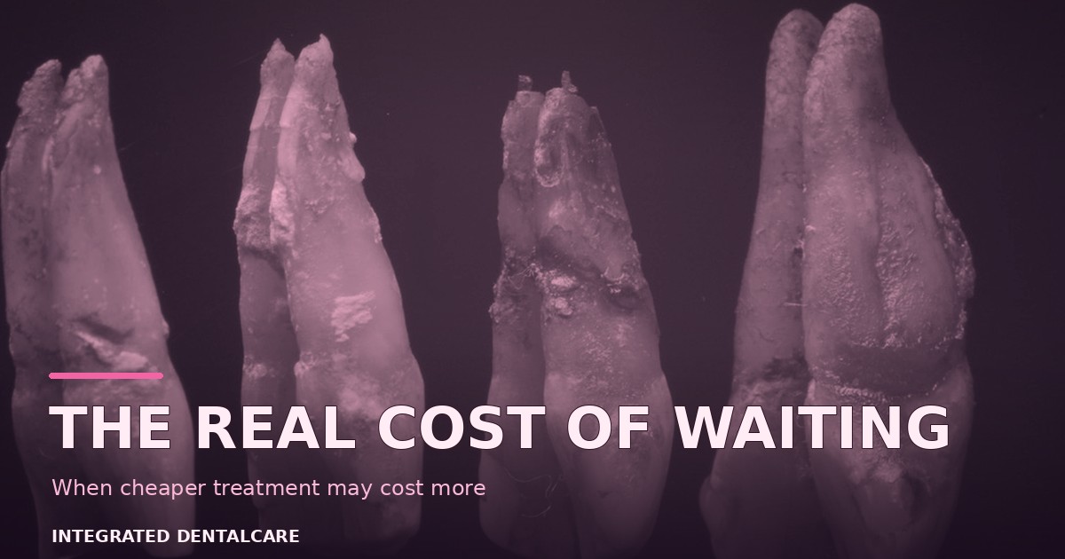 The Real Cost of Waiting: Why “Cheap” Dental Implants Cost More in the End