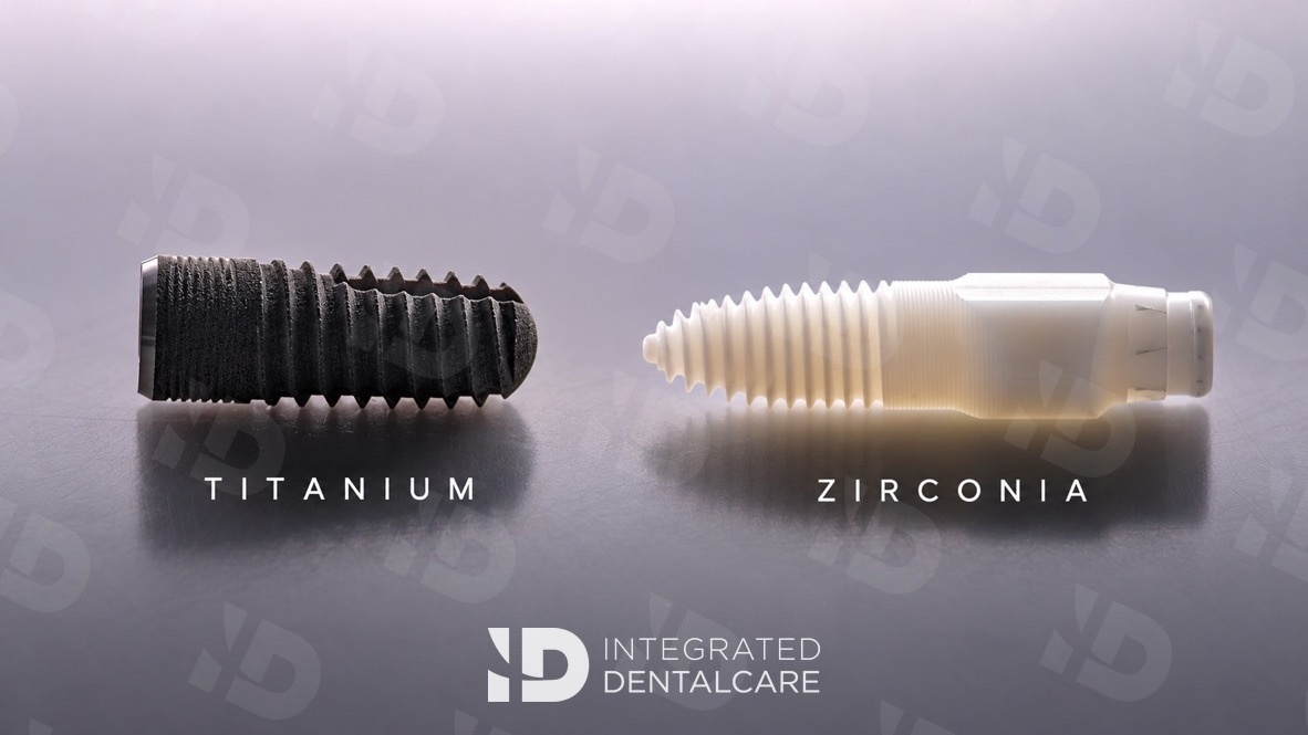 Titanium dental implant next to a white zirconia metal-free implant at Integrated Dentalcare, Edinburgh