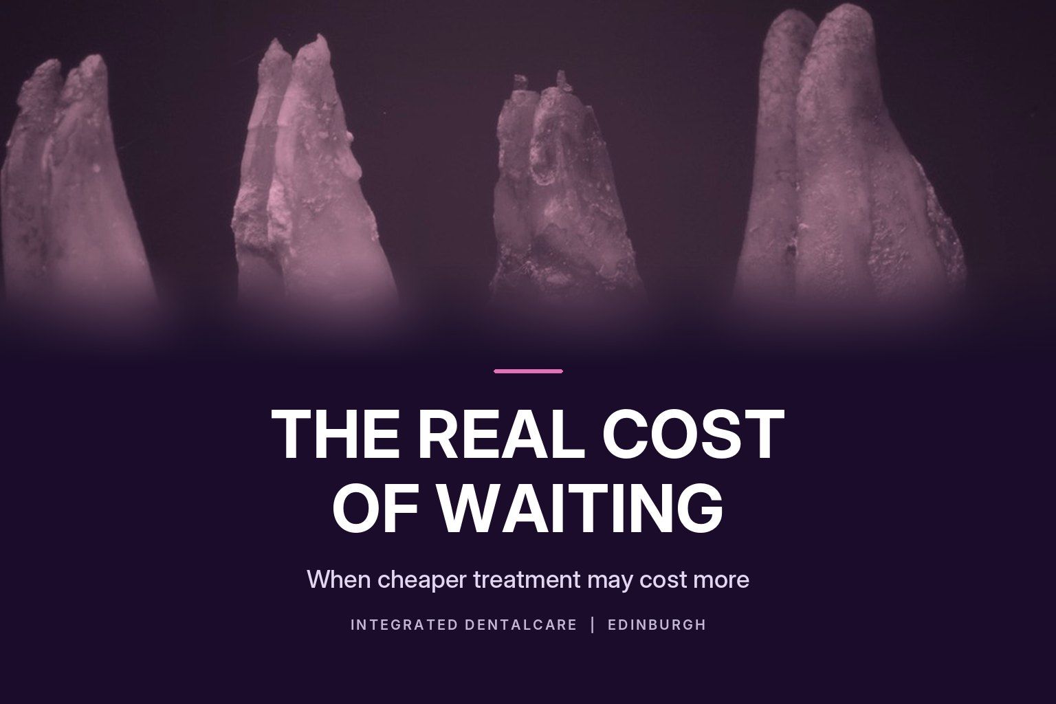 Four extracted teeth fading into a dark purple panel with the title "The Real Cost of Waiting: when cheaper treatment may cost more", Integrated Dentalcare, Edinburgh